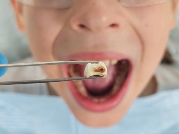 Best Broken Tooth Emergency  in Hominy, OK
